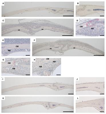 Toll-like receptor-2 induced inflammation causes local bone formation and activates canonical Wnt signaling